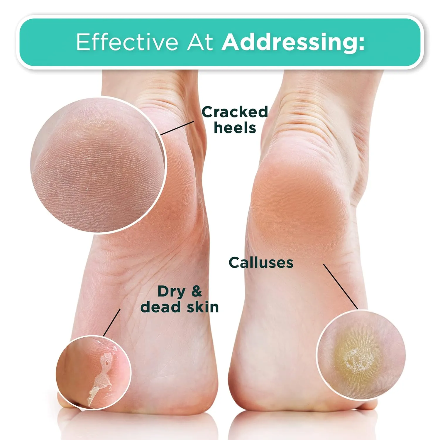 DERMORA Foot Peel Mask - 2 Pack of Regular Size Skin Exfoliating Foot Masks for Dry, Cracked Feet, Callus, Dead Skin Remover for Baby Soft Feet, Peach Scent