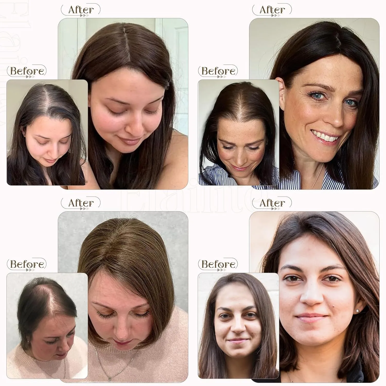 Elailite Hair Toppers for Women - Real Human Hair Free Parting for Thinning Cover, Clip in Pieces for Loss, Gray Fine 6 Inch #1B Natural Black